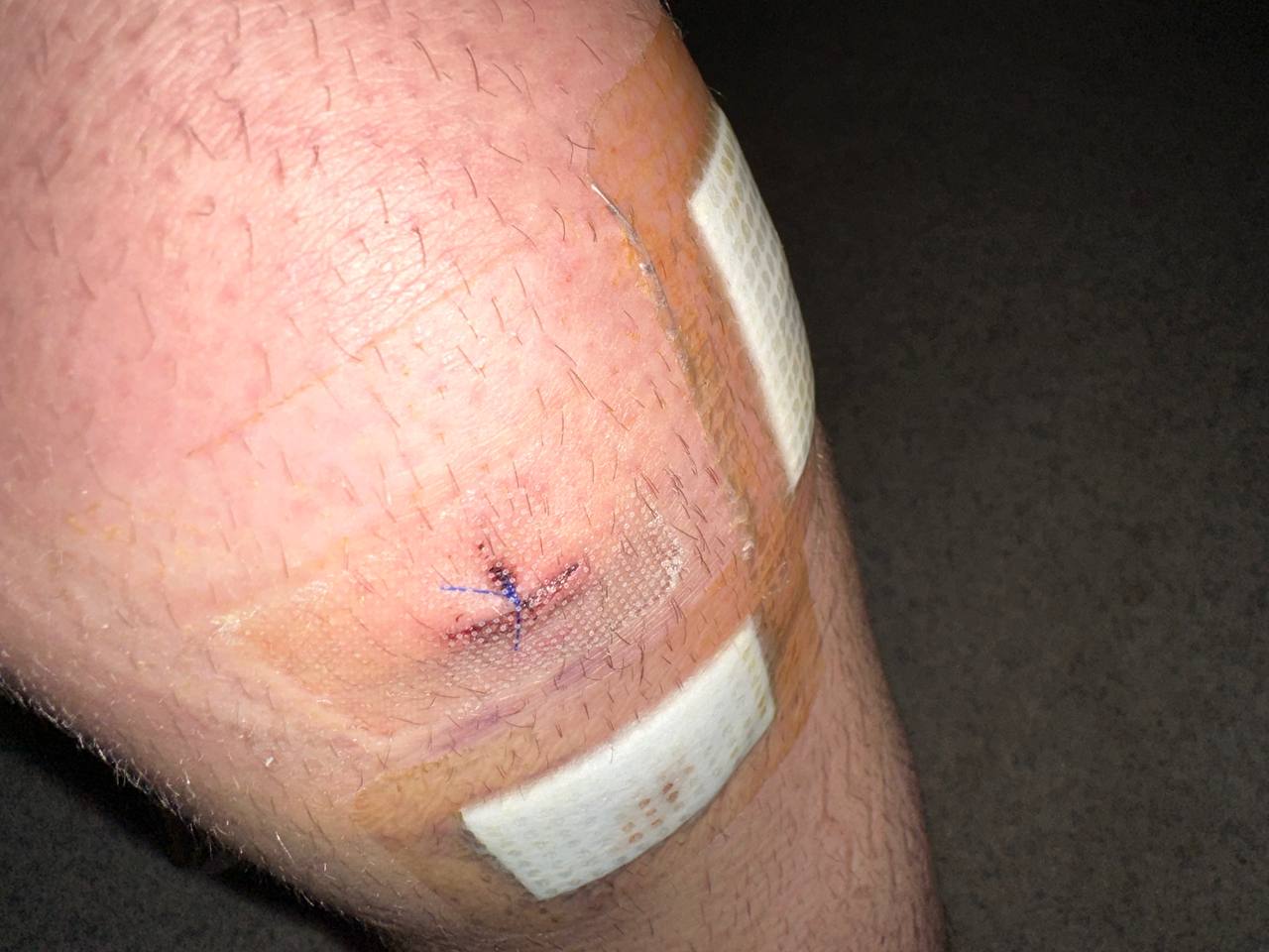 Reparatur: Naht & Futter